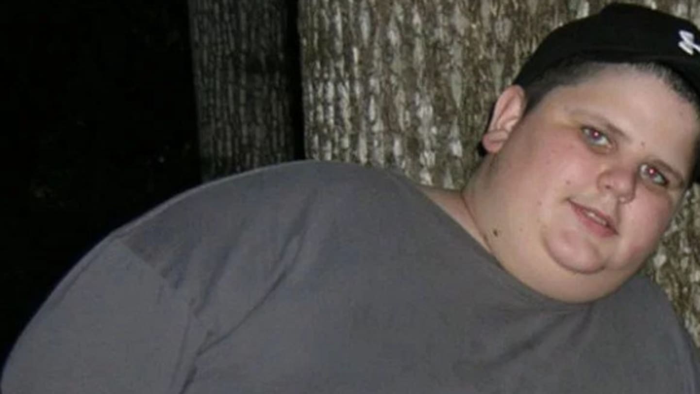 naked fat teenagers - little anal burning man blowjob