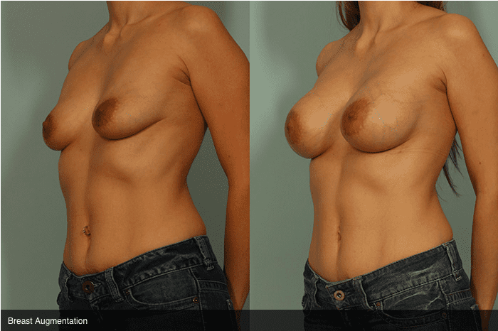 chelsea sturgill like petite perfect tits photo bayu riadi recommends petite perfect tits pic
