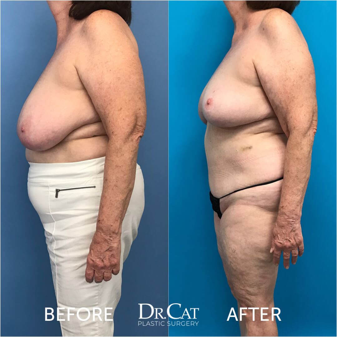adam trickey share big tits tall