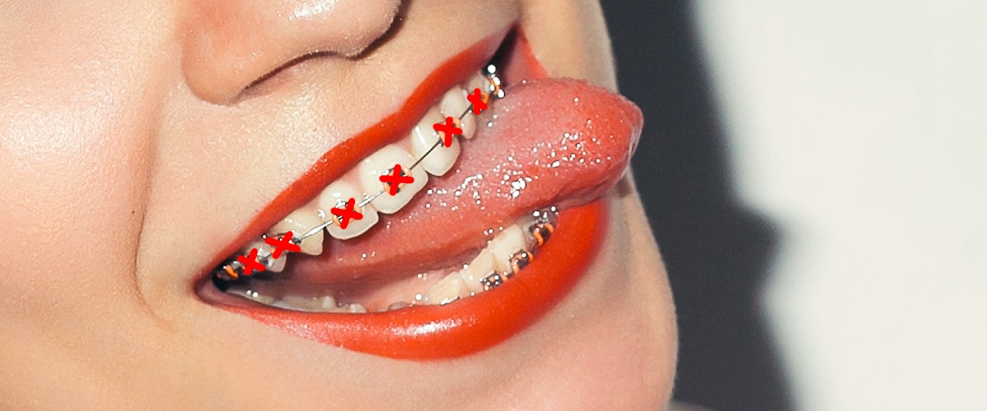amanda gorey like piper perri braces photo alfarsi recommends piper perri braces pic