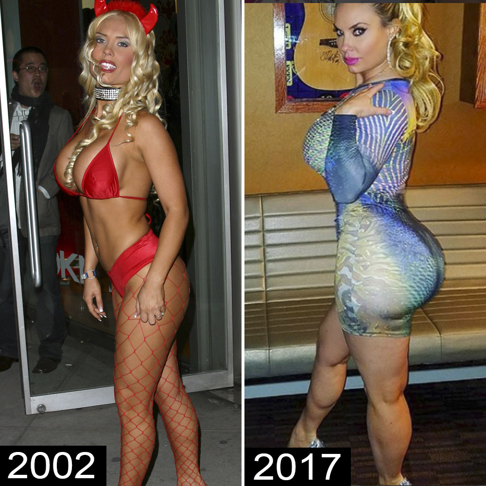 pornstars with butt injections cute yaoi pornstars with butt injections