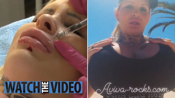 bonnie rotton anal