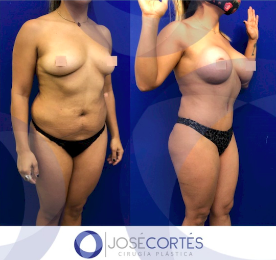 Best of mature twat anthony giammarino share biggest mexican tits photos