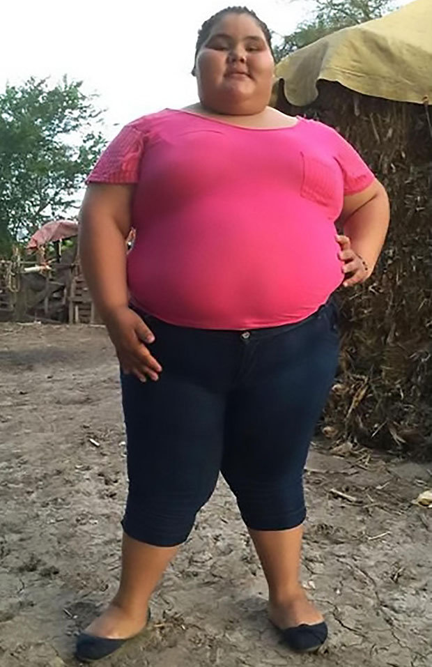 naked fat teenagers - maturetube hairy bunny freedom bbc