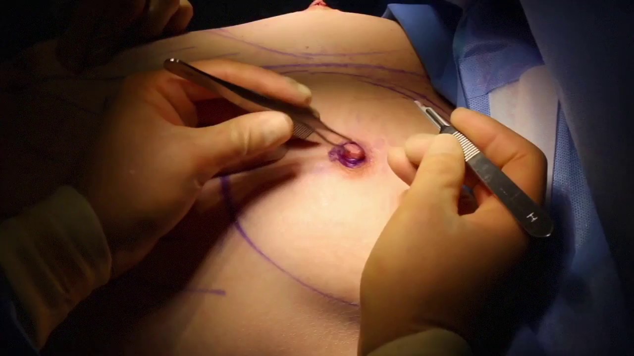 basima yousif like ring video nipple photo bob nordstrom recommends twinks spanking twinks pic