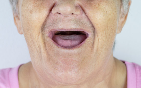 delores meier recommends no teeth old lady pic