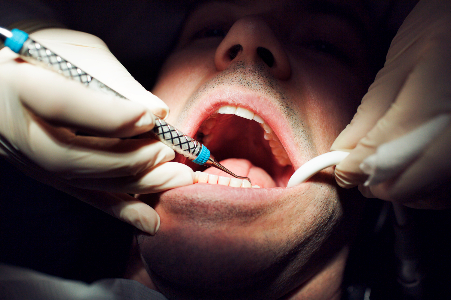 dave appel recommends can i suck dick with braces chris mccurley add can i suck dick with braces photo