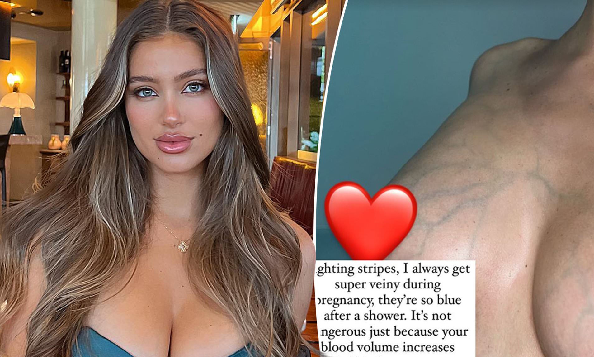 arihant bachhawat recommends Veiny Huge Tits