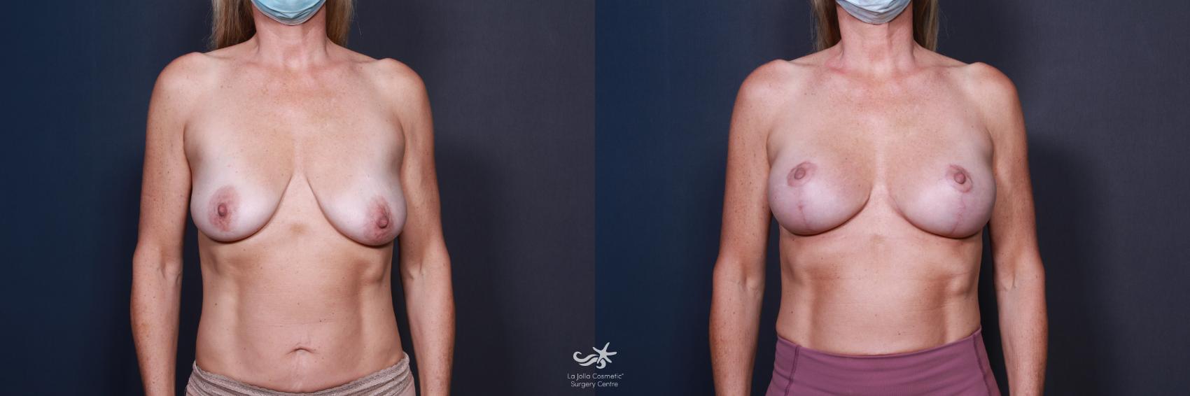 clarence byrd recommends Perky Titties Bouncing