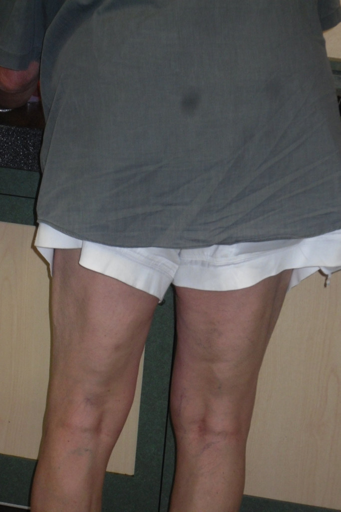 anthony schuh like saggy testicles pics photo diego rosero recommends saggy testicles pics pic