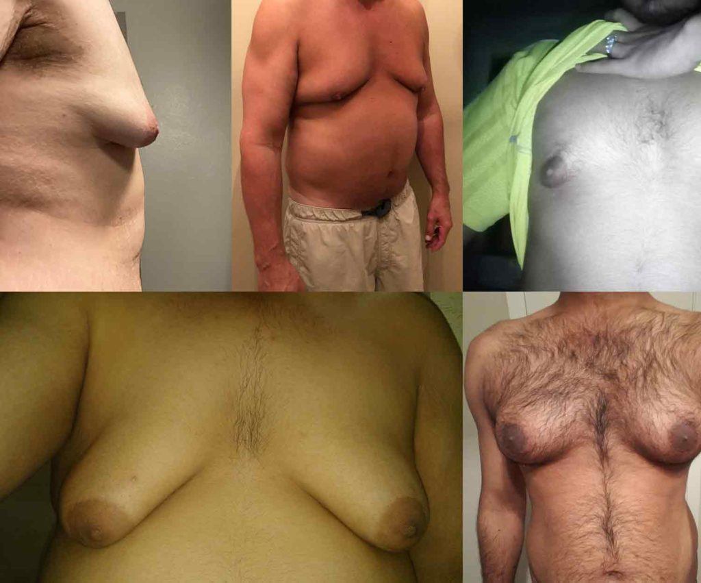 Best of Huge pointed tits