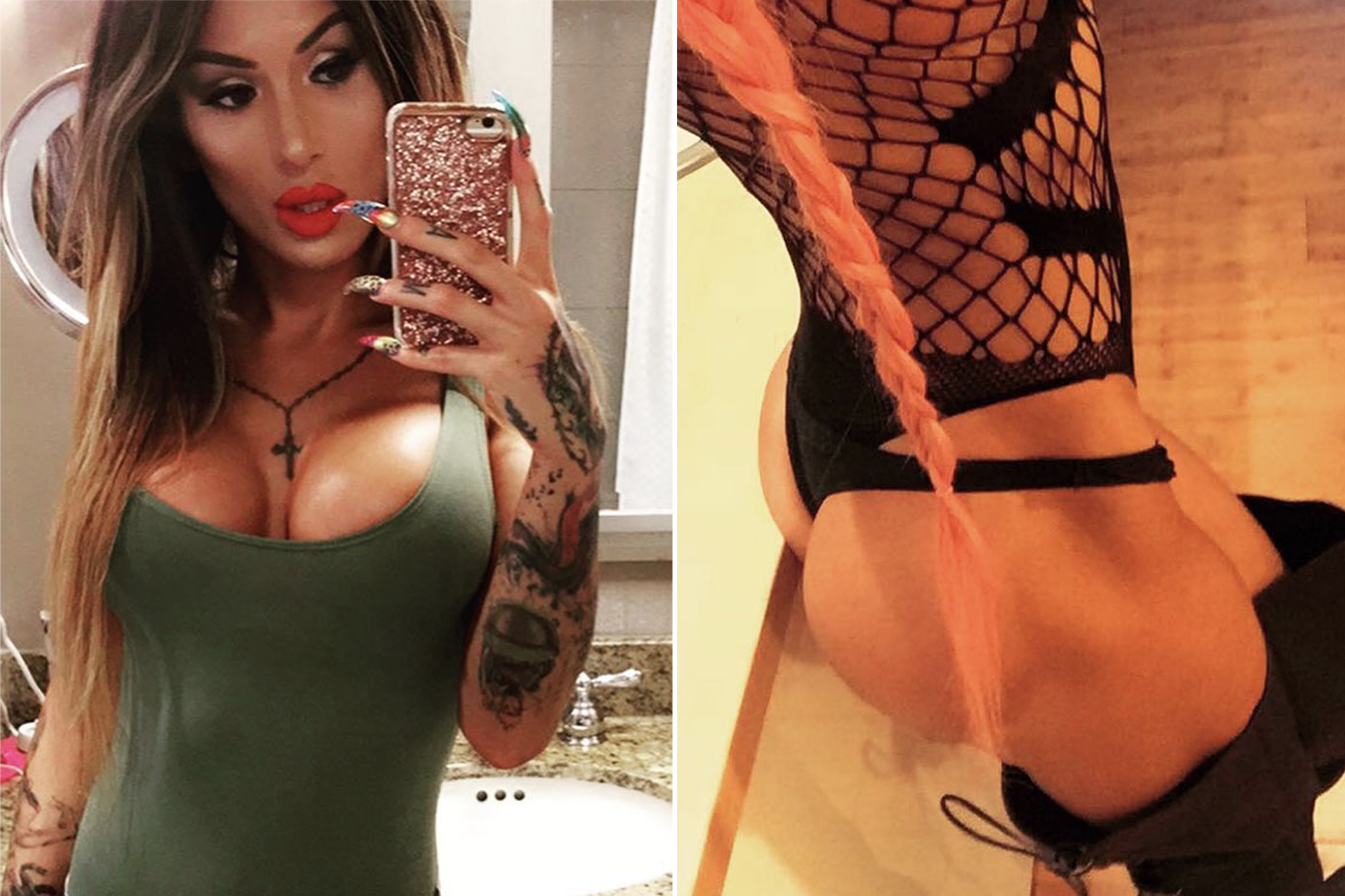 dewi thio recommends Pornstars With Butt Injections