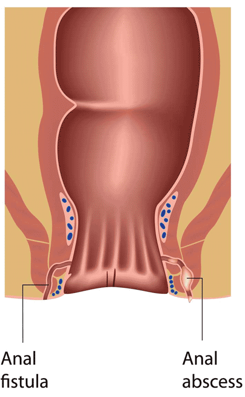 al urso recommends Anal Category
