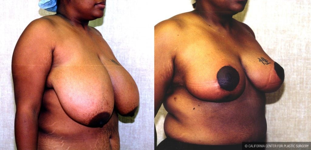 Huge Saggy Titts sur pau chetan lahane recommends Huge Saggy Titts