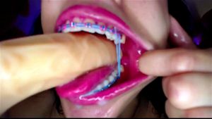 amrita aurora recommends braces deepthroat pic