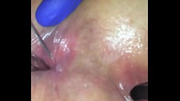butt injection porn - china upskirt south africa porn stars
