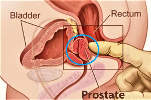 angelo axelrod like sex stories prostate photo bassam halabi recommends juicy pearl pic