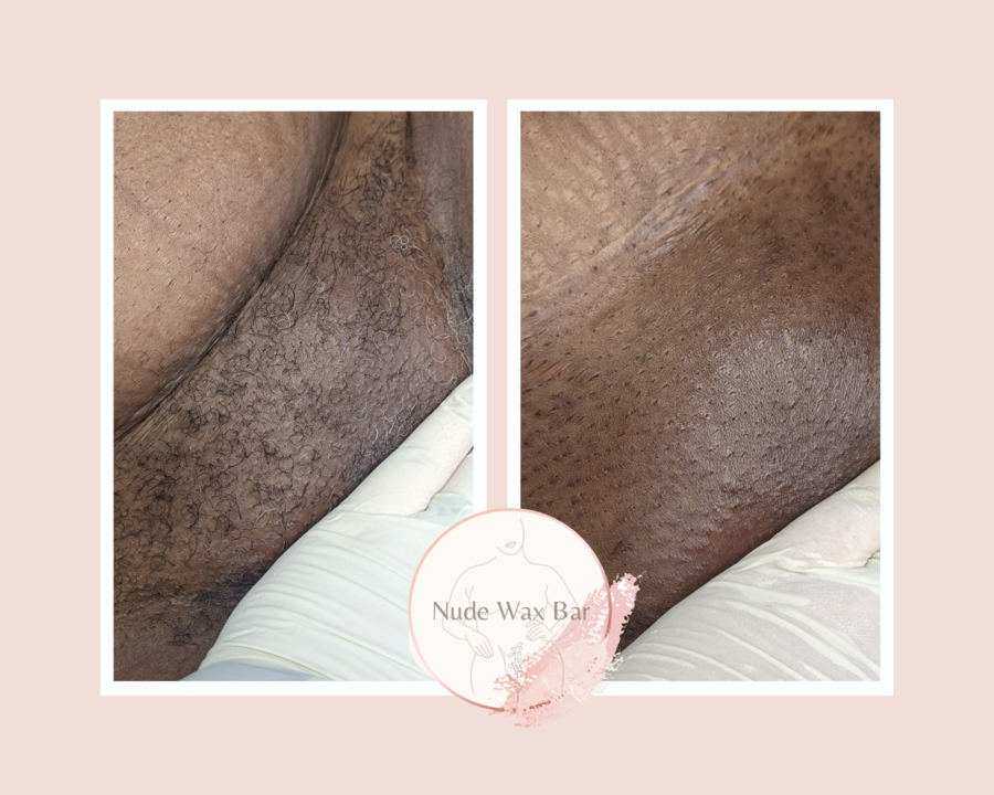bryan brickweg recommends bikini wax nude pic