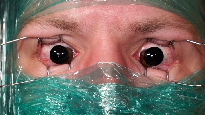 Best of Blackout contacts bdsm