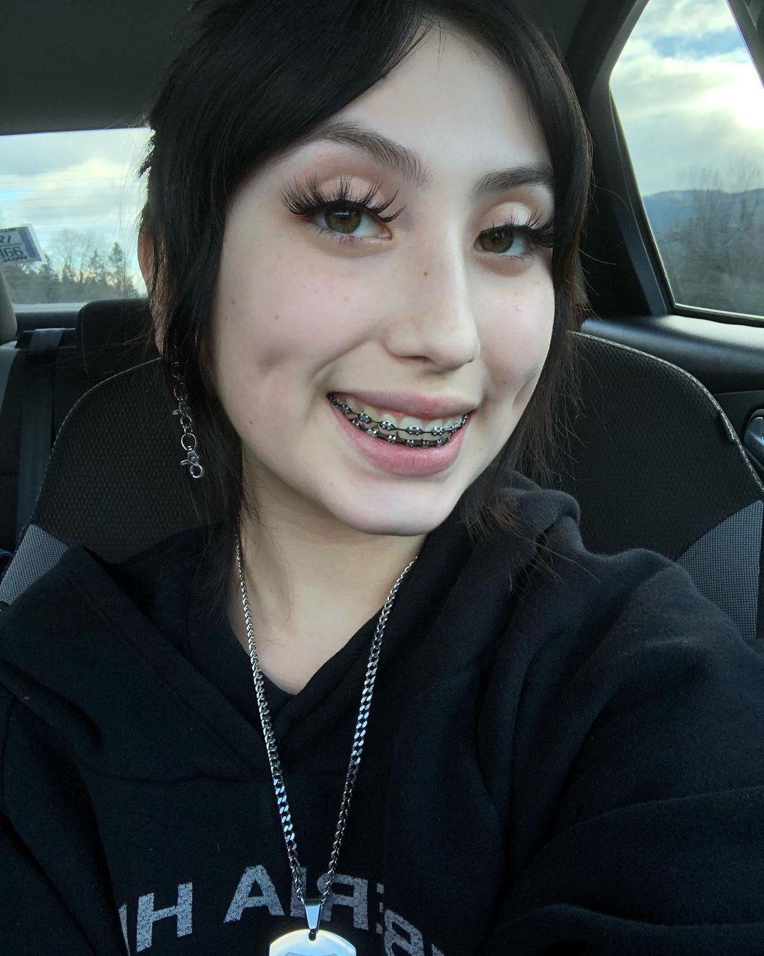 can i suck dick with braces - nude female sports players ltfitt onlyfans