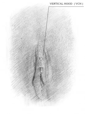 desmond lun recommends tattooed clitoris pic