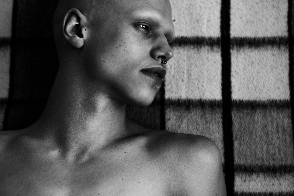 carol frigo recommends bald twinks pic