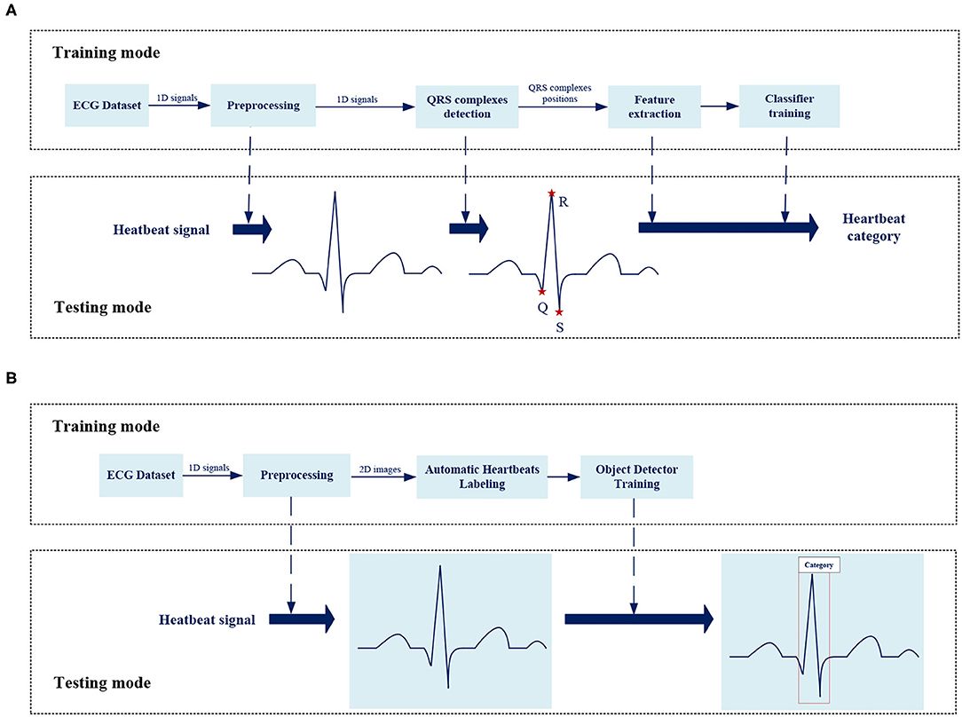 Best of Ecg first anal