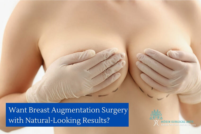 david heape like natural breasts hd photo benny nolan recommends natural breasts hd pic