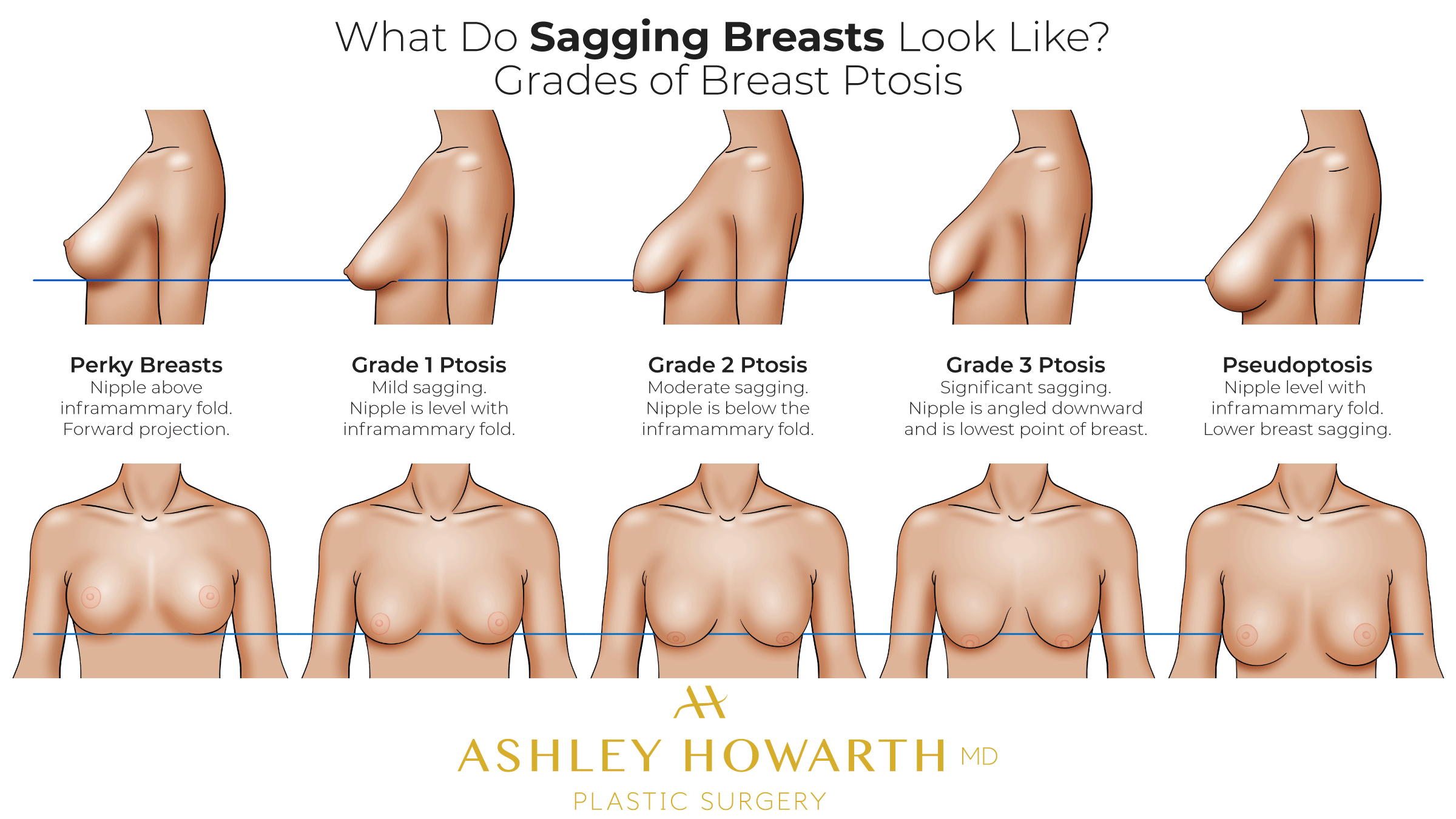 allison zajac recommends naturally perky tits pic