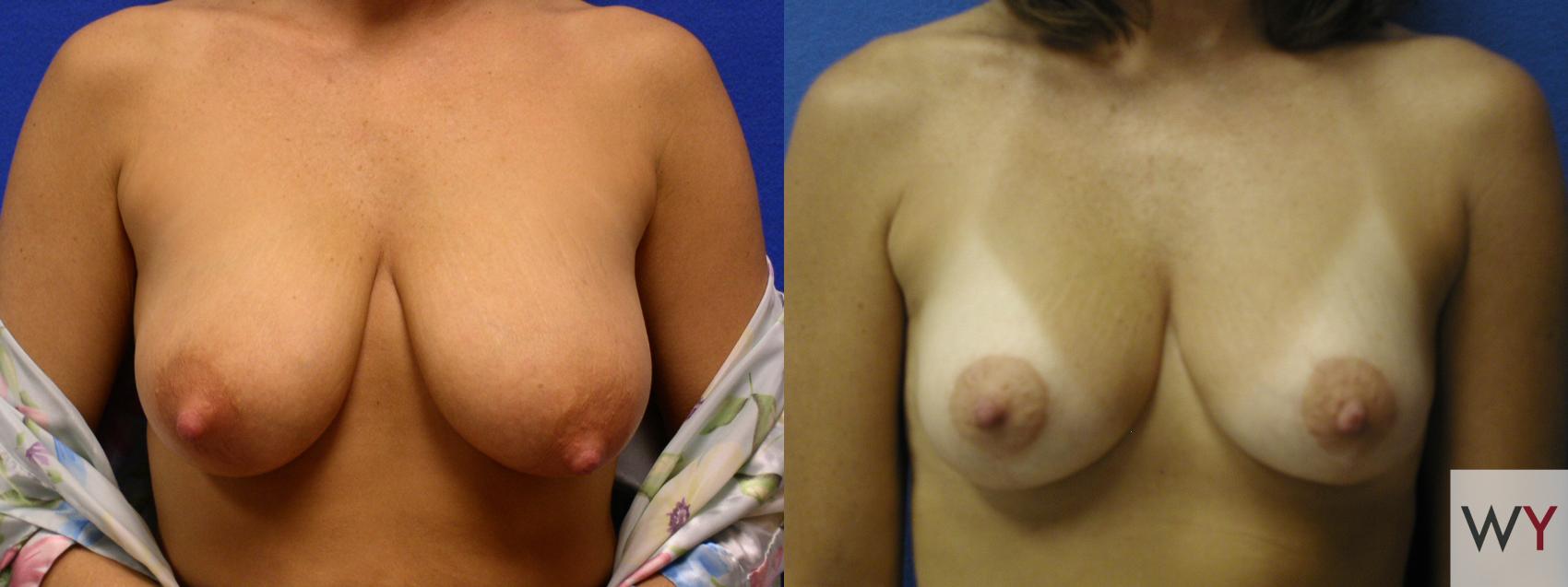 Best of Naturally perky tits