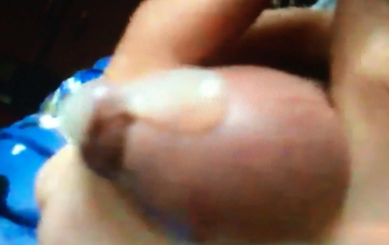 phimosis porn - black and asian threesome lesbian tit sucking