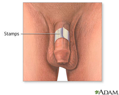 Best of Physical exam boner