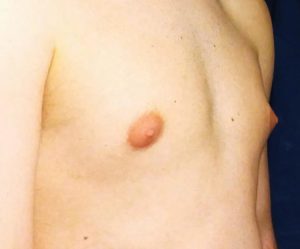 cody koehn recommends Teens blacked porn
