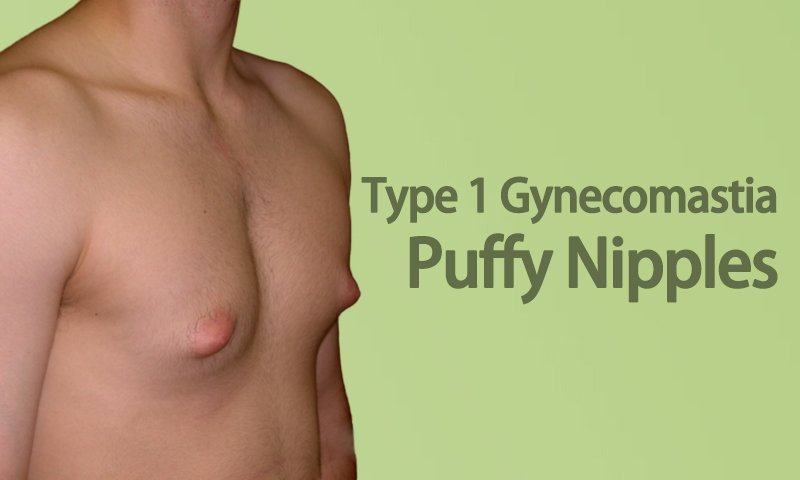 Best of pornografia de honduras benjamin walling share puffy breast video photos