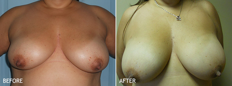 diana godson recommends Sexy Natural Tits