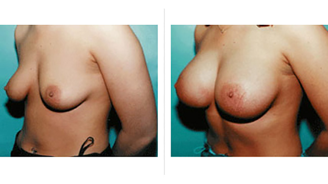 brittany musser recommends Uncensored Titties